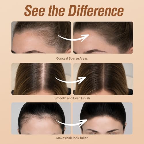 Sevich Hairline Powder 10g, Root Touch Up, Large Capacity, Dark Brown - Image 2