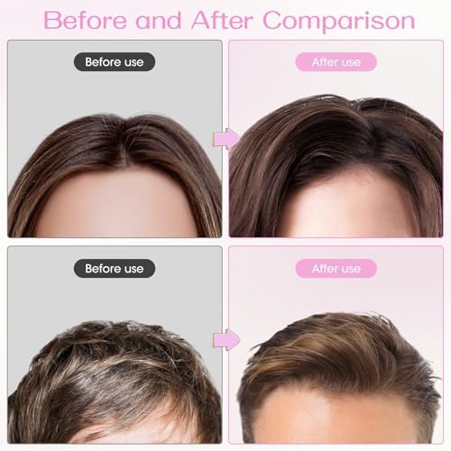 Volumizing Hair Clips for Women 2PCS, Hair Volume Clip Styling Tools Volumizing Comb for Fluffy Bangs Clips for Root Lift, Root Booster Clips - Image 5