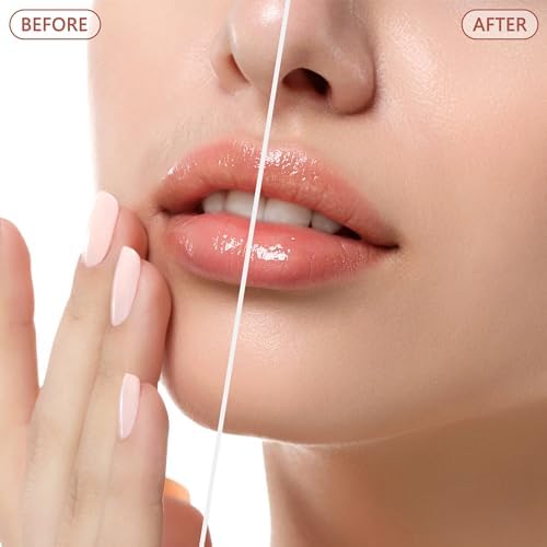 Facial Hair Remover for Women - as Seen on TV Painless Face Shaver - Electric Hair Removal Device for Face Lips Peach Fuzz with Light (White) - Image 3