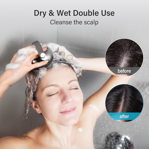arboleaf Scalp Massager Rechargeable Head Massager Scalp Stress Relax - Image 3