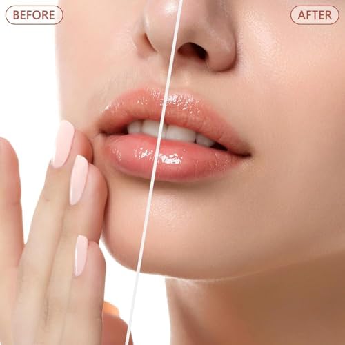 Rechargeable Facial Hair Removal for Women - as Seen on TV Painless Face Shaver - Electric Hair Remover for Face Lips Peach Fuzz with Light with 1 Replacement Heads (Blue) - Image 3