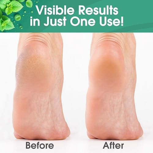 DeEnti Foot Callus Remover Gel, Dead Skin Remover for Feet, 8oz Cool Mint - Image 3