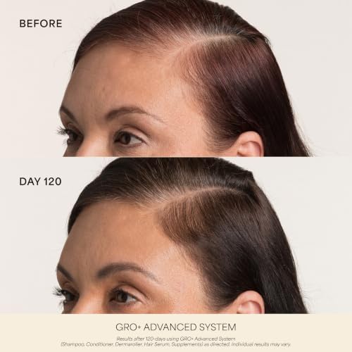 VEGAMOUR Scalp Dermaroller - MD-Developed, 1,200 Medical-Grade Needles, Enhances Serum Absorption, Twist-On Replaceable Head, Protective Case Included - Image 4