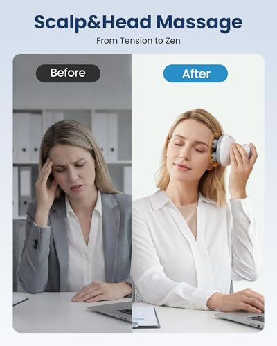 COMFIER Scalp Massager for Hair Growth, Electric Head Massager, Tangle-Free - Image 2