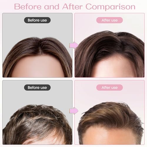 Volumizing Hair Clips for Women 2PCS, Hair Volume Clip Styling Tools Volumizing Comb for Fluffy Bangs Clips for Root Lift, Root Booster Clips - Image 5
