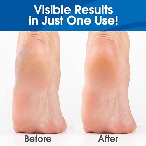 DeEnti Foot Callus Remover Gel, Dead Skin Remover for Feet, 16oz Unscented - Image 3