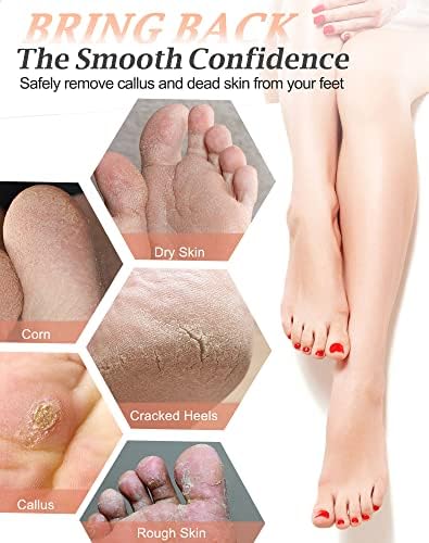 Maryton Natural Pumice Stone for Feet - Lava Foot Exfoliator Scrubber Pedicure Tools, Dead Skin Corn Callus Remover for Feet and Hands, 2 Count - Image 3