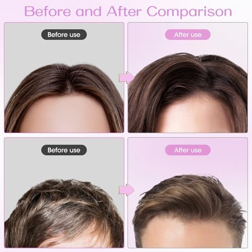 Volumizing Hair Clips for Women 2PCS, Hair Volume Clip Styling Tools Volumizing Comb for Fluffy Bangs Clips for Root Lift, Root Booster Clips - Image 5