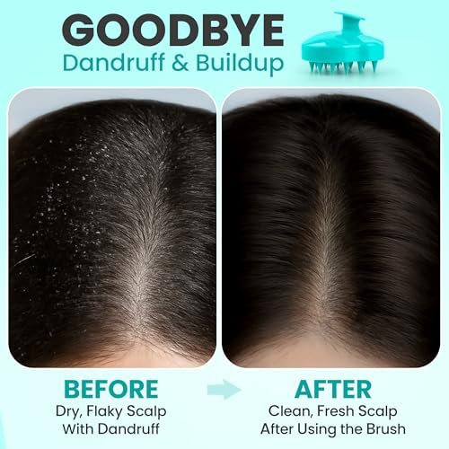 RELAXXO Scalp Massager Hair Growth – Exfoliator & Hair Scrubber for Scalp, Soft Bristles for Dandruff & Soothing Comfort, Shampoo Brush, Wet & Dry Use, Green - Image 3