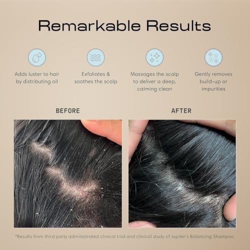 Jupiter Scalp Exfoliator - Scalp Massager Tool for Wet & Dry Hair - Ergonomic Detangler Brush - Dandruff Comb & Scrub to Remove Dandruff & Buildup and Support Circulation - 2 Pack, Black - Image 2