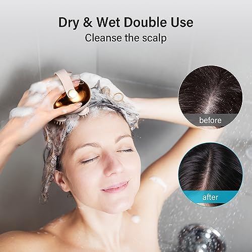 arboleaf Electric Scalp Massager Head Massager Scalp Stress Relax - Image 4