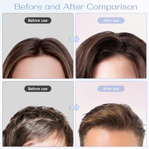 Volumizing Hair Clips for Women 2PCS, Hair Volume Clip Styling Tools Volumizing Comb for Fluffy Bangs Clips for Root Lift, Root Booster Clips - Image 5