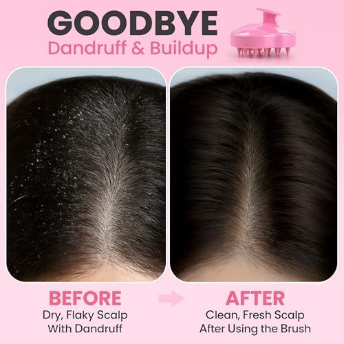 RELAXXO Scalp Massager Hair Growth – Exfoliator & Hair Scrubber for Scalp, Soft Bristles for Dandruff & Soothing Comfort, Shampoo Brush, Wet & Dry Use, Pink - Image 3