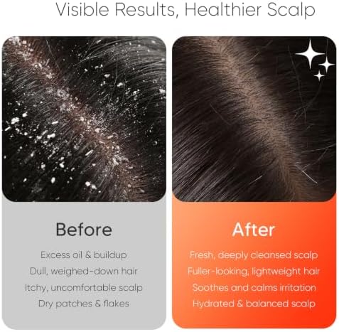 EKZ Vibrating Silicone Scalp Massager Shampoo Brush, Electric Hair Scrubber - Image 3